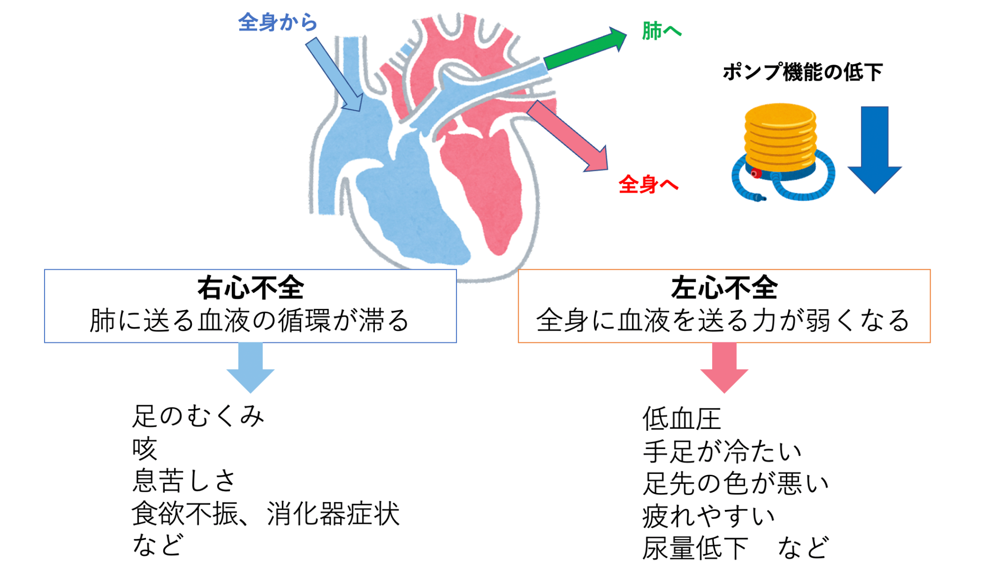 慢性心不全